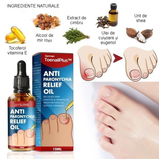 Ulei esential antimicoze, Unghii Ingrosate, Ciuperca unghiei, Anti-Paronychia si intarirea placii unghiale
