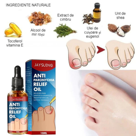 Ulei esential antimicoze, Unghii Ingrosate, Ciuperca unghiei, Anti-Paronychia si intarirea placii unghiale